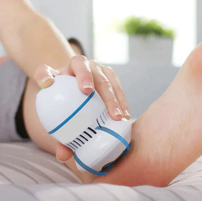 Glowvera Vacuum Callus Remover